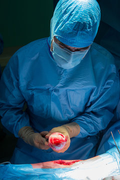 HIP PROSTHESIS, SURGERY