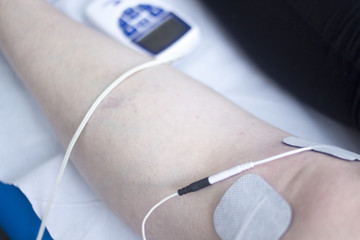 Physical therapy acupunture