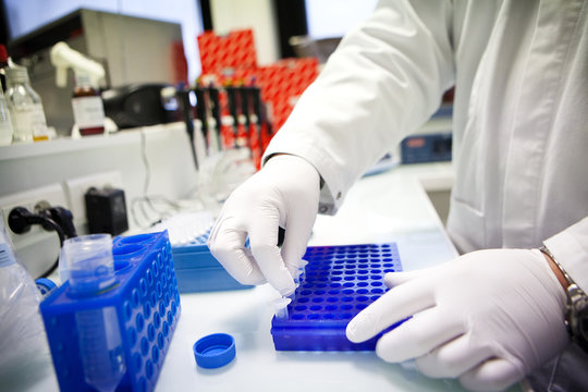 AIDS, RESEARCH