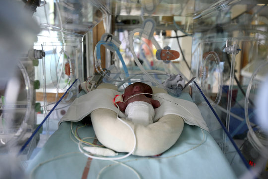 PREMATURE BABY