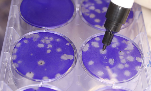 VIROLOGY LABORATORY