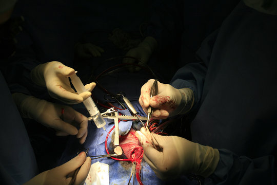 HEART SURGERY