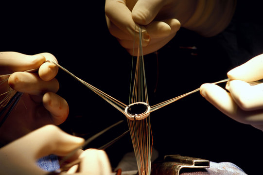 HEART VALVE PROSTHESIS