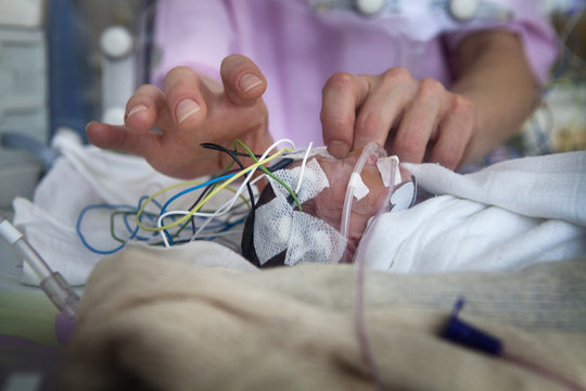 NEONATOLOGY