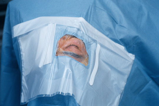EYE SURGERY
