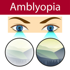Optician, Vision Of Eyesight Vector Illustration