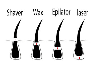 Vector diagram of different methods of hair removal - obrazy, fototapety, plakaty