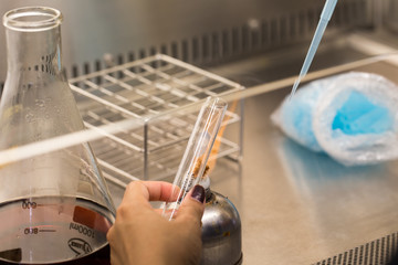 Bacteria in culture medium test tube for education in Laboratory.