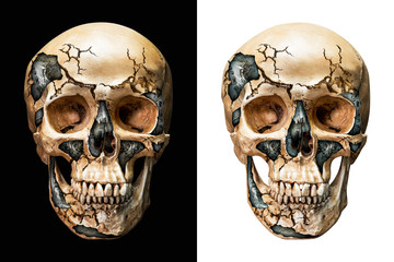 Steel inside human skull