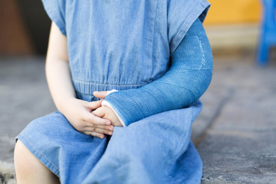 Close up of girl in denim dress with broken arm
