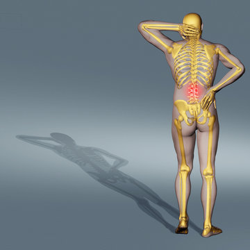 Computer-generated illustration of back pain