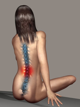 Illustration of a woman with back pain