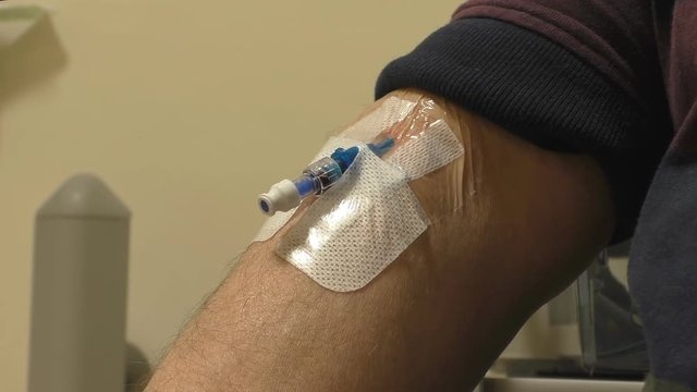 A peripheral venous catheter inserted into man's vein in elbow area close up.