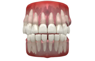 Denti Umani, Dentista, Dentizione, Anatomia