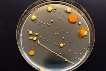 A petri dish with growing cultures of microorganisms, fungi and microbes. A Petri dish  ( Petrie dish) known as a Petri plate or cell-culture dish