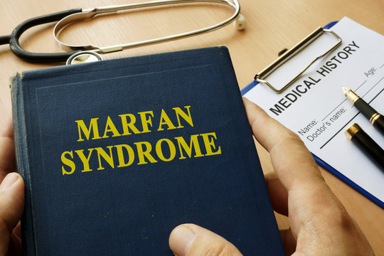 Book with title Marfan Syndrome on a table.
