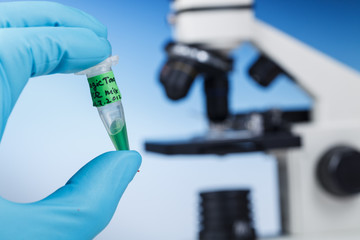 Microscope Subject Table and Biological Samples. Microscope is the main research tool in many scientific microbiology laboratories