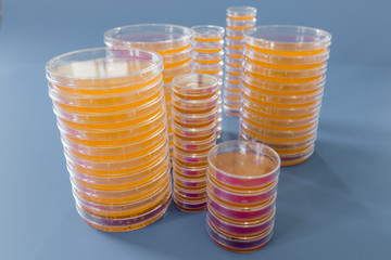 Pile of petri dish with growing cultures of microorganisms, fungi and microbes. A Petri dish  (...