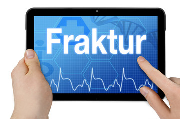 Tablet mit Diagnose Fraktur