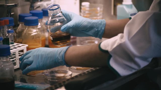 technician with loop and petri dish in the laboratory / hand of Doctor making a urine culture in a petri dish