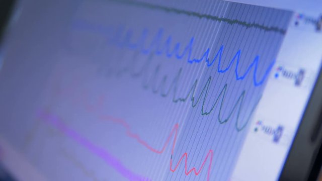 Lie detector's graphs on computer.