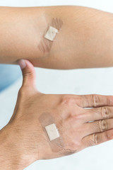Scars on both arms from a syringe,putting plaster on wounds