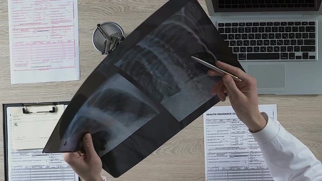 Pulmonologist carefully examining patients lungs X-ray, noting suspicious areas