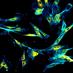Immunofluorescence confocal imaging of fibroblasts with endoplasmic reticulum in yellow and cytoskeleton in cyan - 160013234