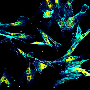 Immunofluorescence confocal imaging of fibroblasts with endoplasmic reticulum in yellow and cytoskeleton in cyan