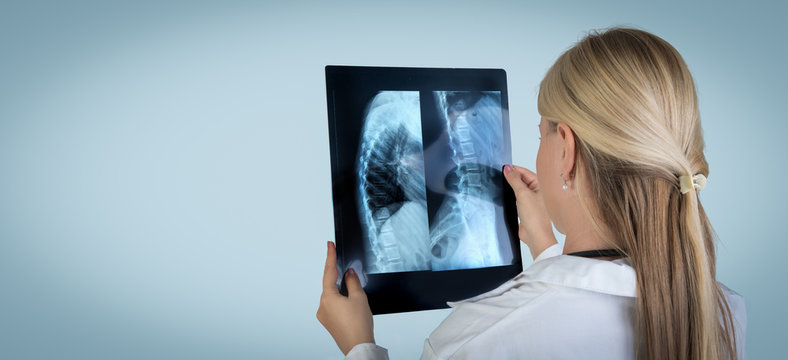 female blonde doctor with x-rays