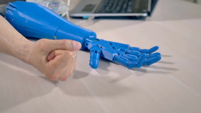 A human arm clenches a tight fist to test a bionic hand.