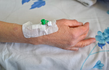 Peripheral intravenous catheter for vascular access placed in a vein on the lower arm and closed by...