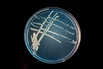 Pile petri dish with growing cultures of microorganisms in doctor hand , fungi and microbes. A...