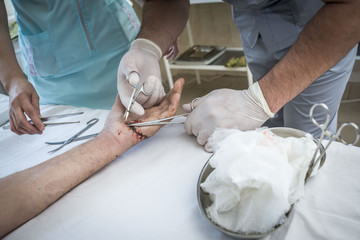 the surgeon sews up the wound of the patient
