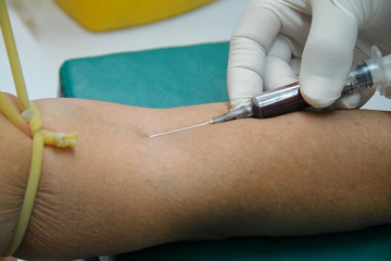 Taking of a blood sample