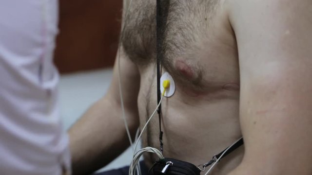 Female doctor attaching electrodes on patient's chest to daily monitoring