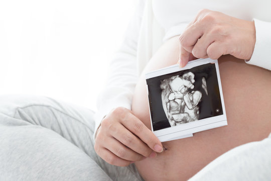 Pregnant woman holding examining x-ray picture, Ultrasound pregnancy concept