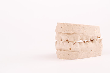 Gypsum model human jaws prothetic laboratory. Dental casting