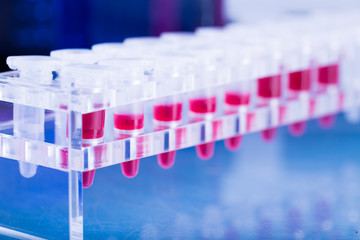 test tube for cancer  blood test