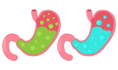 Sick and healthy stomach. Flat style. Vector illustration