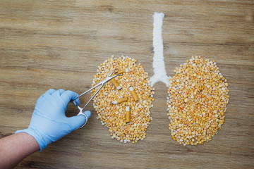 Doctor taking cigarette butts stubs out of human lungs made of dry peas. Smoking health risks, breathing polluted air concept issue. Lung disease cancer tumor surgery. Smoking is bad for your lungs