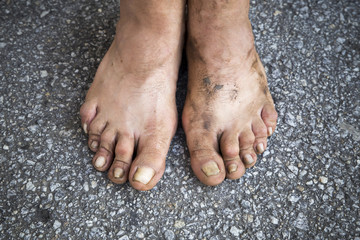 Feet of a human being who lives on the street.