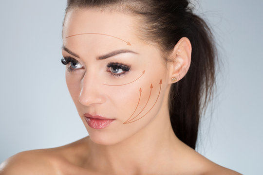Young serious woman with surgical markers on face