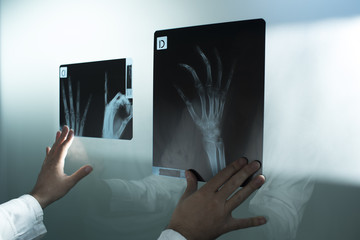 Examining hand x ray