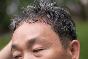 old senior or middle aged man with grey hair problem