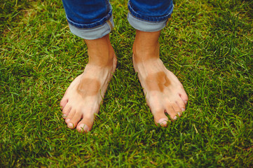 Legs of a man with an uneven tan