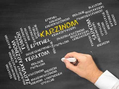 Karzinom