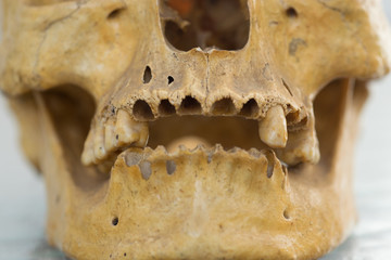 Human skull teeth