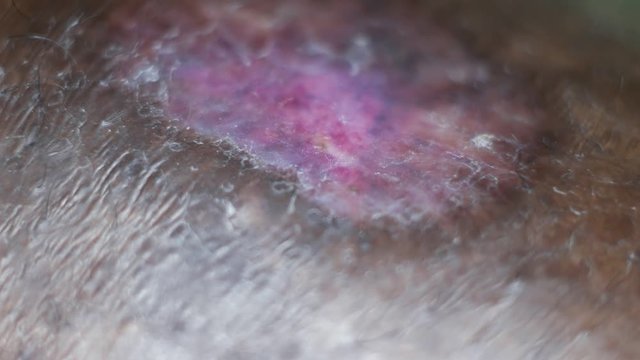 Close up of Human Skin Texture 
