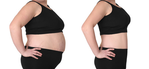 Female body before and after weightloss on white background. Health care and diet concept - obrazy, fototapety, plakaty